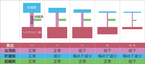 貧血、不妊、フェリチン、貯蔵鉄